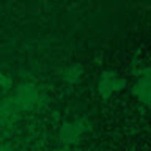 Meet your Posher, Lou